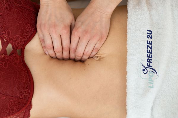 diastasis recti treatment Bradford-on-Avon