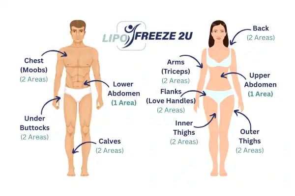 Areas you can have fat freezing treatment Bradford-on-Avon