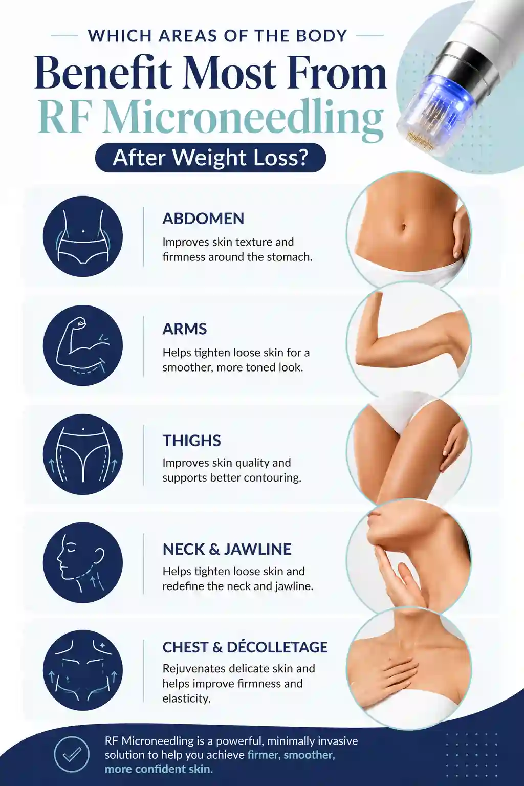 Which Areas of the Body Benefit Most From RF Microneedling After Weight Loss Bradford-on-Avon